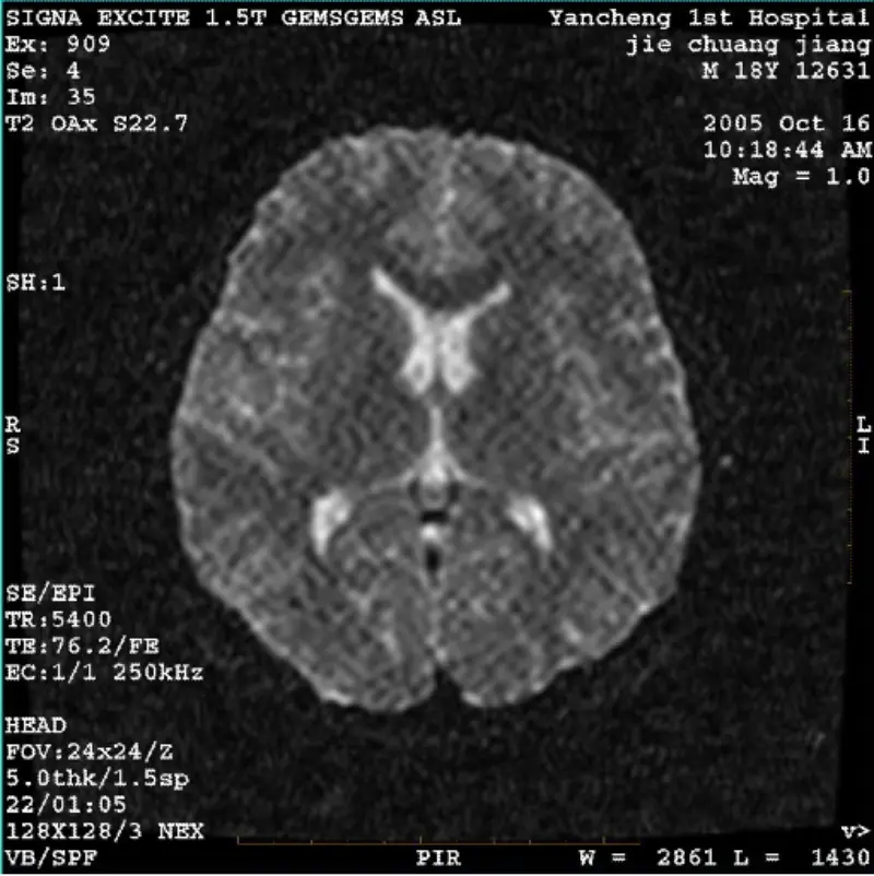 ARTIFACT WI/Fiesta 이미지 흰색 픽셀