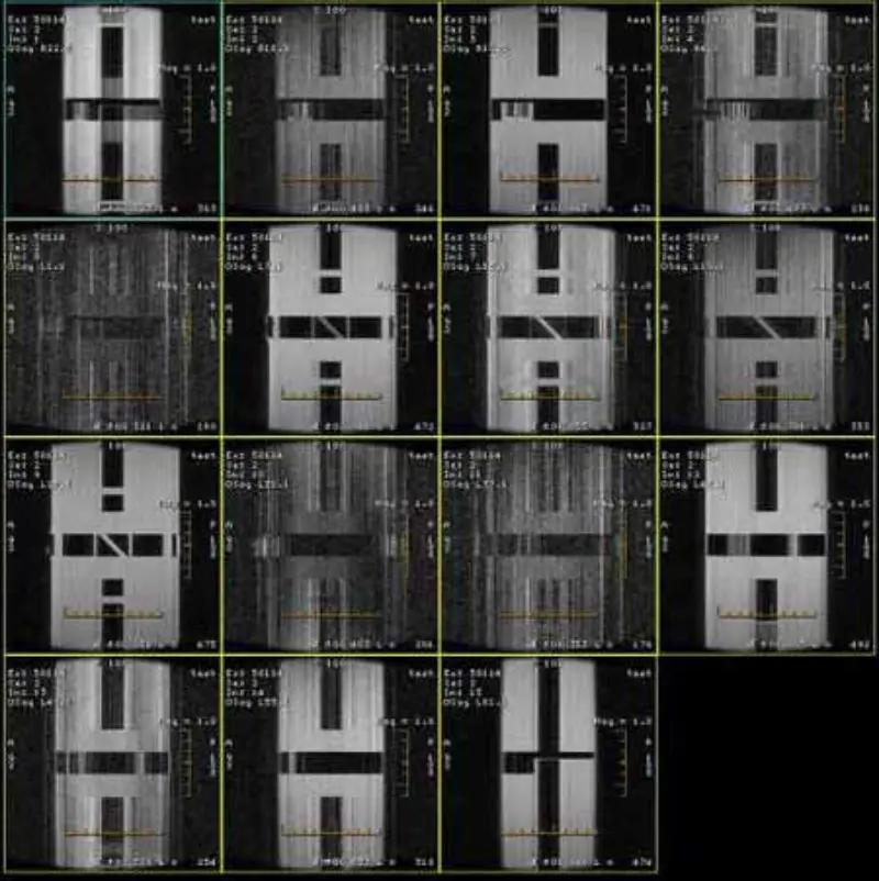 FSE 및 GRE 아티팩트